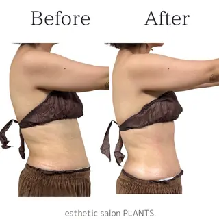 esthetic salon PLANTS所属・エステティックサロン PLANTSのエステ・リラクイメージ