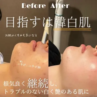 LUMIERE福岡春吉店所属・LUMIERE 福岡のエステ・リラクイメージ