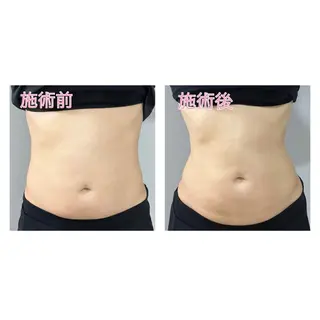 全身もみほぐし もみの樹のエステ・リラクイメージ