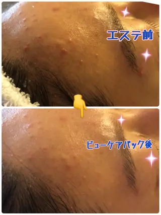 メナードフェイシャルサロン西区天塚所属・平岩 仁美のエステ・リラクイメージ