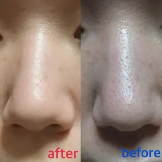 メンズ vio la〜ヴィオラ〜所属・エステティシャン ちえりのエステ・リラクイメージ