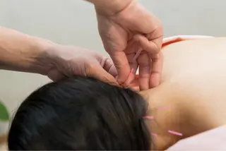 鍼・マッサージ 吉村治療院のエステ・リラクイメージ