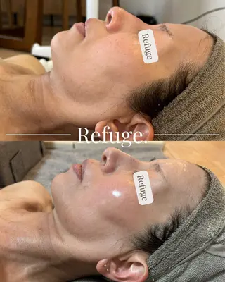 グリーンピール専門サロン Refuge.所属・Refuge. （リフュージュ）のエステ・リラクイメージ