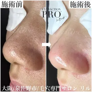 隅田 都布子のマツエク・マツパデザイン