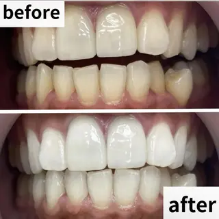 LBSホワイトニング 🌐渋谷店 小河原のエステ・リラクイメージ