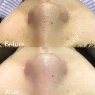 メンズ アンベリー 北浜店のエステ・リラクイメージ