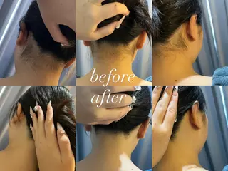 うなじ脱毛/美肌脱毛 LABELのエステ・リラクイメージ