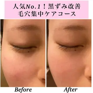 Bellesthe （ベルエステ）のエステ・リラクイメージ