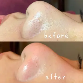 美肌蘇生カウンセラー 横山りえのエステ・リラクイメージ