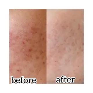 laluna saki...のその他イメージ