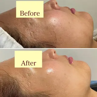 メンズ歓迎🙆‍♀️ エステ/ネイルISTのネイルデザイン