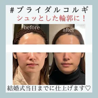 小嶋萌 今池駅徒歩2分のエステ・リラクイメージ