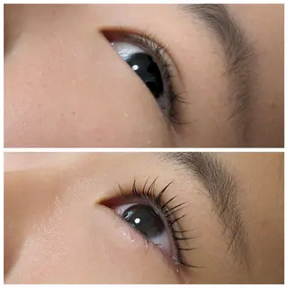 結果が出るスキンケア 肌質改善/まつパのエステ・リラクイメージ