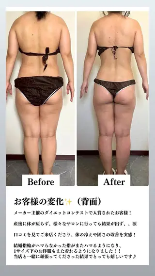 痩身&小顔矯正専門店 Re:Livesのその他イメージ