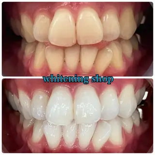 メンズ ホワイトニング ショップ川越店のエステ・リラクイメージ