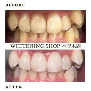メンズ ホワイトニング ショップ本厚木のその他イメージ