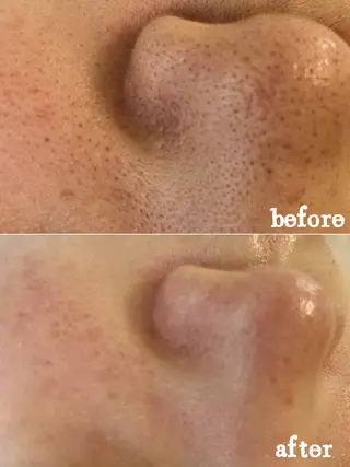 Nature Souce毛穴専門店のその他イメージ