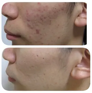 メンズ 肌質改善専門 鈴木悠のエステ・リラクイメージ