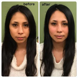 美容鍼 IKEZAKIのエステ・リラクイメージ