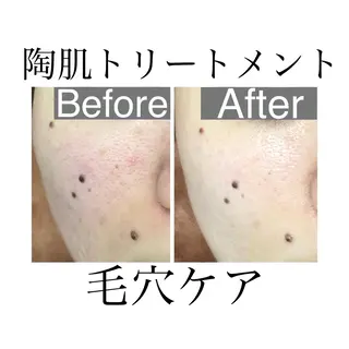 ルアナアイナ 大分のエステ・リラクイメージ