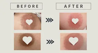 小顔/たるみ/黒ずみ除去専門サロン/SONA 大和西大寺店所属・【小顔専門看護師 サロンSONA】のエステ・リラクイメージ