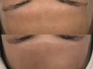 べアール所属・小顔/毛穴/ニキビ salon bealのエステ・リラクイメージ