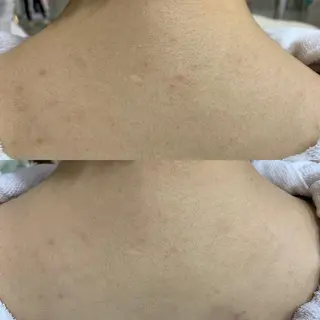 エステティック＆リラクゼーションサロンいぐなる所属・いぐなる 清水のエステ・リラクイメージ