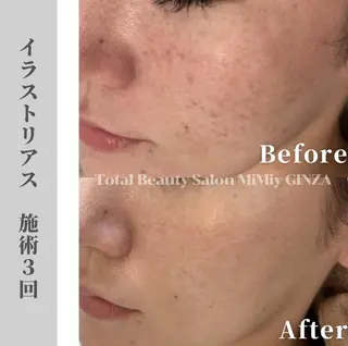 MiMiy 銀座店のエステ・リラクイメージ