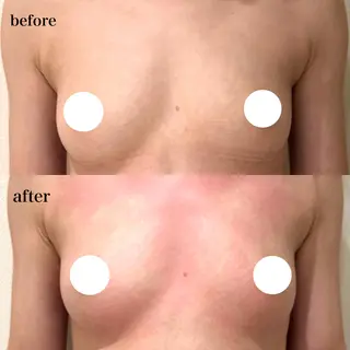 beautysalon RAVIS所属・東大阪/韓国肌管理/ 痩身バスト専門店のエステ・リラクイメージ