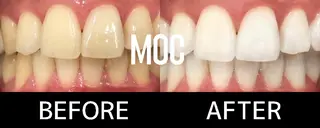 歯科提携セルフダック 宇都宮駒生店のエステ・リラクイメージ