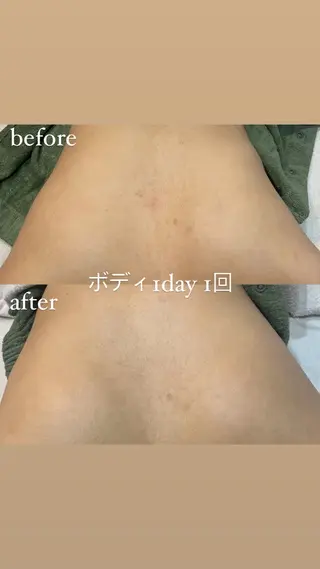 brilliance所属・老化肌トラブル肌専門 Brillianceのエステ・リラクイメージ