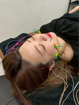 美容鍼・小顔矯正 FLOW 鍼灸整体院のその他イメージ