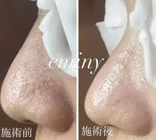 EMINY （エステティシャン）のエステ・リラクイメージ