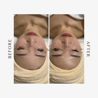 東海エリア1位受賞 長江香保のエステ・リラクイメージ