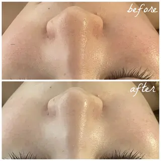 メンズ メナード岐阜市茜部 杉浦のエステ・リラクイメージ