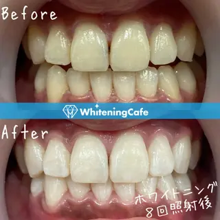 ホワイトニングカフェ神戸元町店所属・ホワイトニングカフェ 神戸元町店のエステ・リラクイメージ