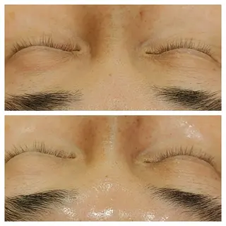 라라피（ララピ）所属・韓国式肌管理 ララピール専門のエステ・リラクイメージ