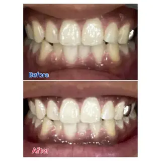 M渋谷店所属・M渋谷 ホワイトニングのエステ・リラクイメージ