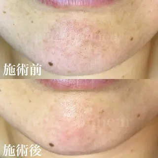 槙谷 あさみのエステ・リラクイメージ