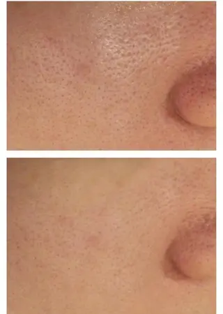 ロング カラー パーマ ヘアアレンジ メンズ キッズ ネイル マツエク・マツパ アイブロウ ニキビ特化型エステ 🍓最短で肌質改善のエステ・リラクイメージ