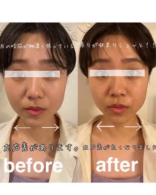 美容鍼灸サロン mahoroba院長のエステ・リラクイメージ