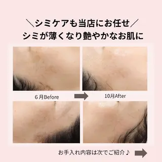 PRETTIEST SHINE所属・山田 浩子のエステ・リラクイメージ