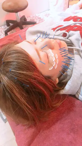 美容鍼灸女性専用 りんご鍼灸治療院のエステ・リラクイメージ