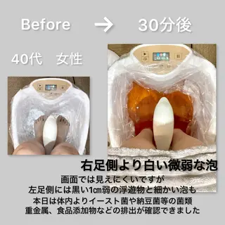 頭皮アンチエイジング L＋　秋葉原上野のエステ・リラクイメージ