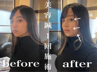 鍼灸整骨院Refine所属・鍼灸 Refineのその他イメージ