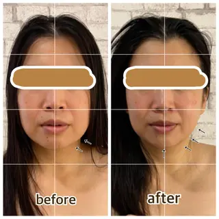 salon ace所属・【小顔矯正】 salonaceのエステ・リラクイメージ