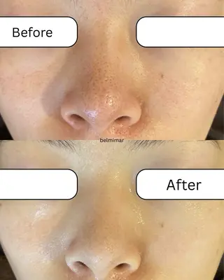 南森町・肌質改善 BELMIMARのエステ・リラクイメージ