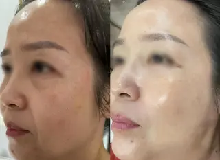 aliaハイフ&水光ジェットサロン所属・aliaハーブ水光店 エステティシャン募集のエステ・リラクイメージ