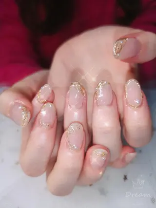 ミディアム ネイル フィルイン、長さ出し 深爪矯正のネイルデザイン