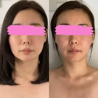 美顔をDESIGN 代表Mamoruのエステ・リラクイメージ